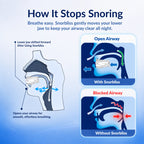 Diagram showing how the Snorbliss mouthpiece moves the lower jaw forward to keep the airway open